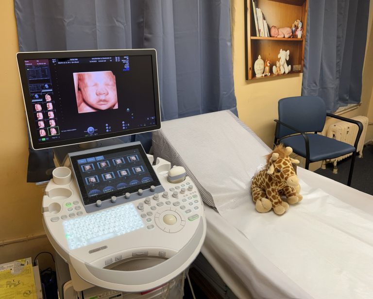 🗓️ The Golden Window: Optimal Timing for Your 3D/4D/HDLive Ultrasound Keepsake