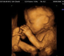 3d-ultrasound-23weeks4days
