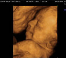 3d-ultrasound-25weeks2days