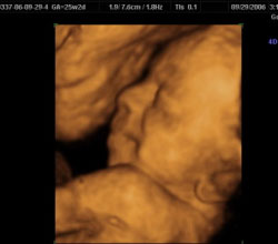 3d ultrasound 25 weeks 2 days