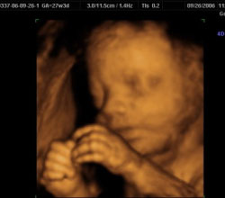 3d ultrasound 27 weeks 3 days