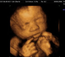 3d-ultrasound-28weeks1day