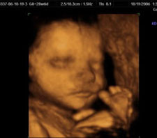 3d-ultrasound-28weeks6days