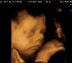 3d ultrasound 29 weeks 6 days