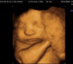 3d ultrasound 31 weeks