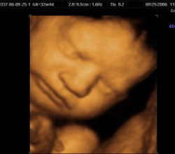 3d ultrasound 32 weeks 4 days