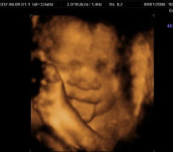 3d ultrasound 32 weeks 6 days