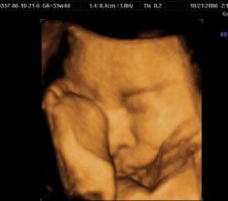 3d ultrasound 33 weeks 4 days