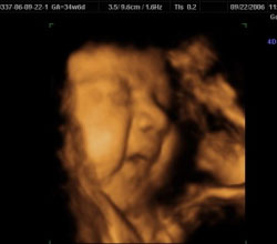 3d ultrasound 34 weeks 6 days