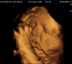 3d ultrasound 35 weeks 5 days