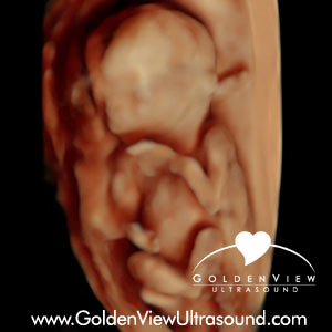 Goldenview-HD-15-weeks-5-days