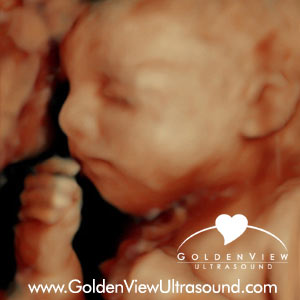 Goldenview-HD-Live-30-weeks