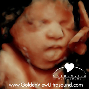 Goldenview-HD-Live-31-weeks