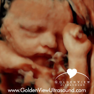 Goldenview-HD-Live-32-weeks-front