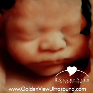 goldenview-hd-live-36-weeks-full-face