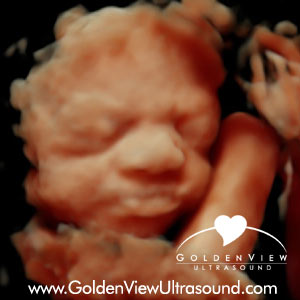 Goldenview-HD-live-28-weeks-0914