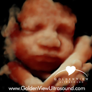 Goldenview-HD-live-30-weeks-0914
