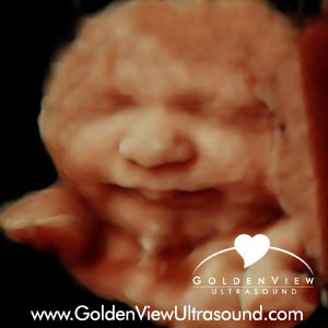 Goldenview-HD-live-33-weeks