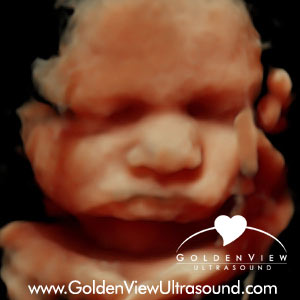 Goldenview-HD-live-34-weeks-0914