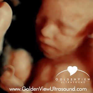 Goldenview-HDlive-twins-25-weeks