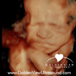 Goldenview-HDlive-twins2-25-weeks