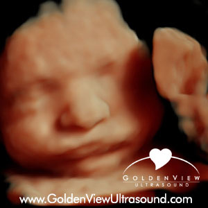 goldenview-HDlive-ultrasound-27-weeks