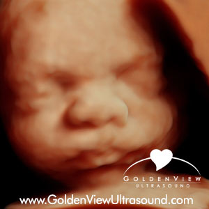30 weeks hd ultrasound