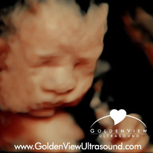 goldenview ultrasound san antonio 27 weeks