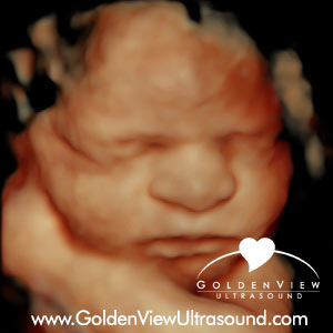 goldenview ultrasound san antonio 29 weeks
