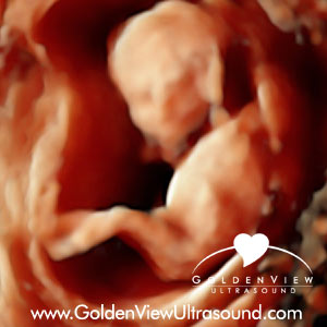 goldenview-13-weeks-hd-live