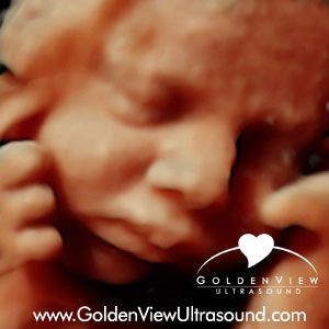 goldenview-HD-Live-35-weeks