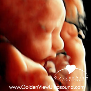 goldenview-HD-ultrasound-32-weeks