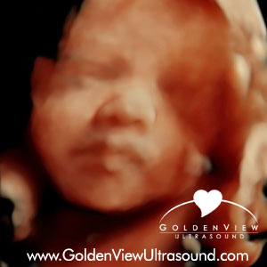 goldenview-HDlive-ultrasound-28-weeks-3days
