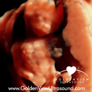goldenview-hd-live-17-weeks