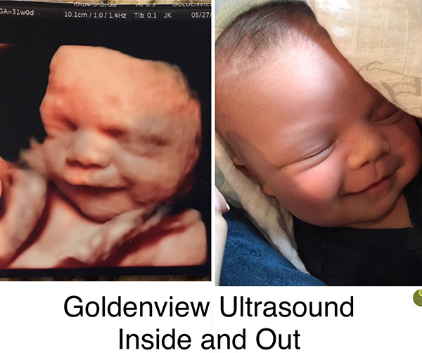 when is the best time to get 3d ultrasound pictures