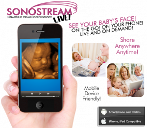 Sonostream LIVE - share your 4d ultrasound over the internet on mobile devices including phones and tablets